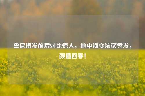 鲁尼植发前后对比惊人，地中海变浓密秀发，颜值回春！